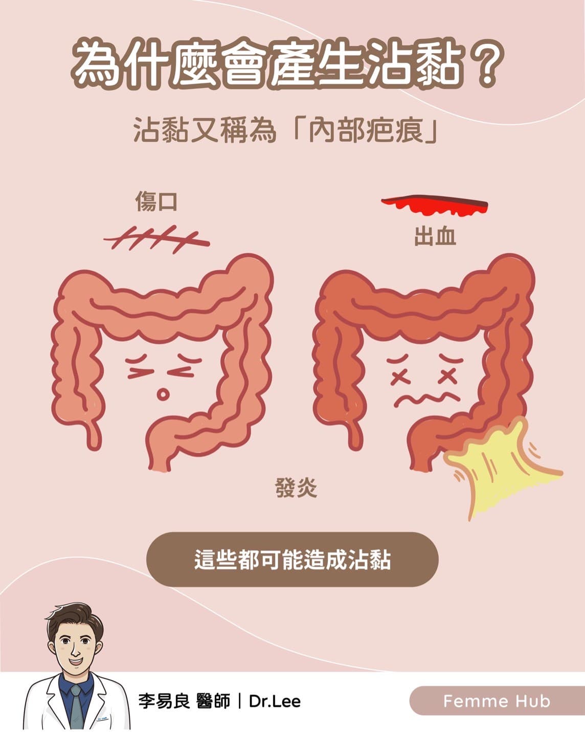 👨🏻⚕️為什麼會有手術後沾黏發生⁉️1.jpg