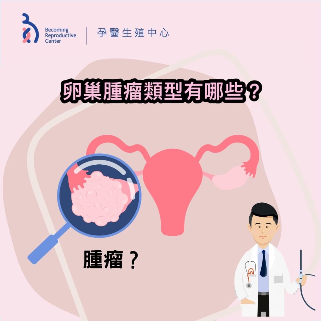 婦科常見的卵巢囊腫或卵巢腫瘤.jpg
